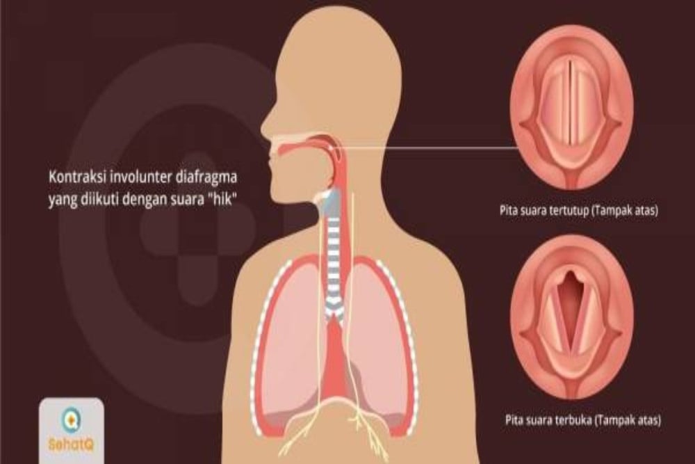 Ini Arti Suara-suara Aneh dari Tubuh, Termasuk Perut Keroncongan dan Cegukan